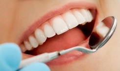 Các dấu hiệu cho thấy răng bạn có nguy cơ bị sâu răng?